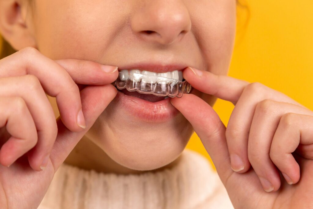 How to Play the clarinet with braces